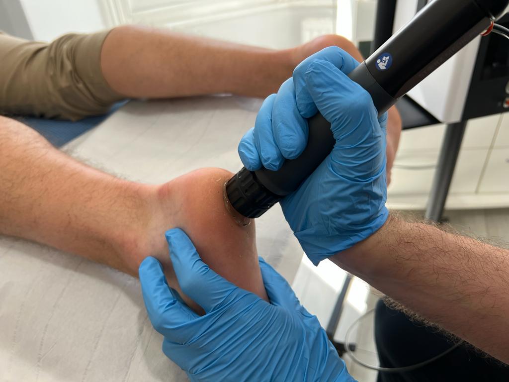 Shockwave Therapy Cutting Edge Podiatry