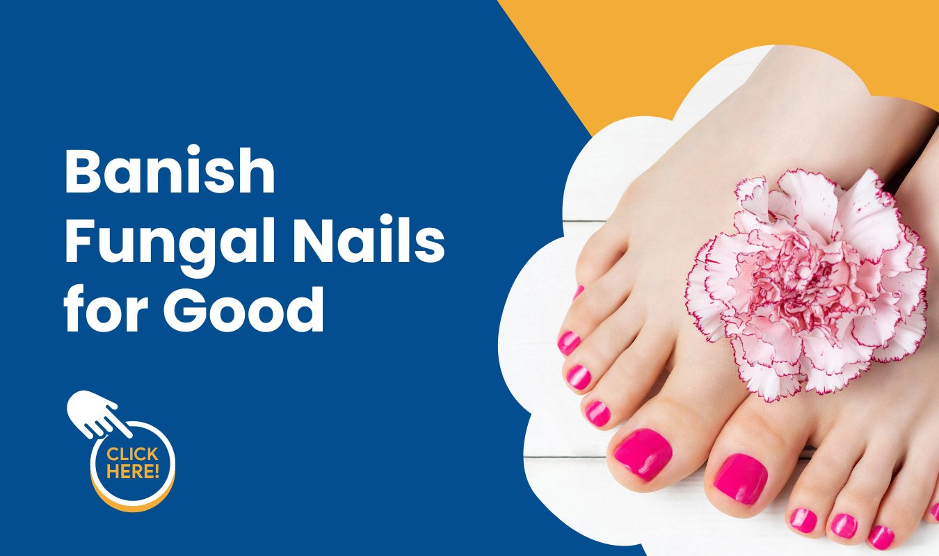 banish fungal nails for good (1350 x 800 px) (1) padel injury prevention