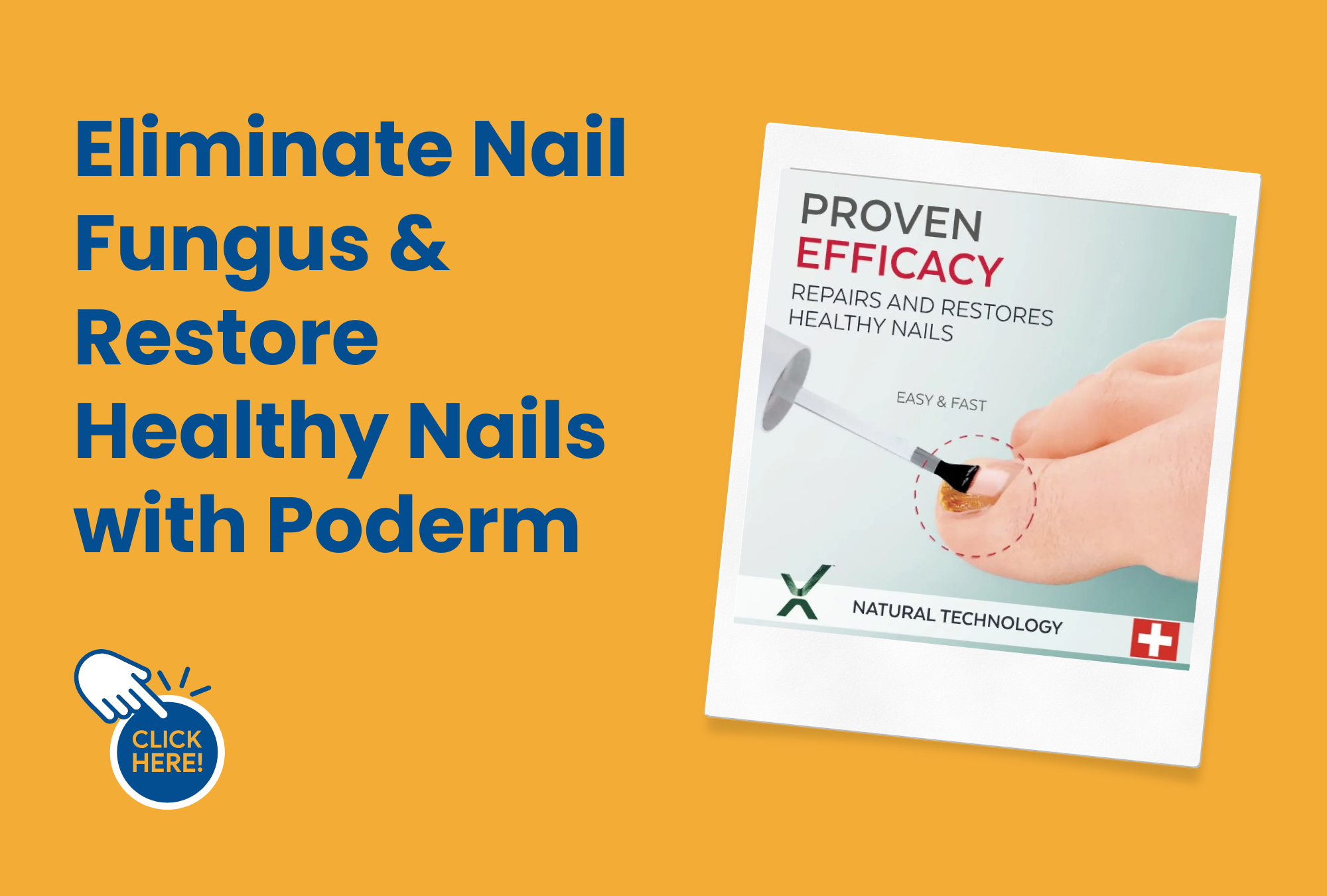 poderm for fungal nails