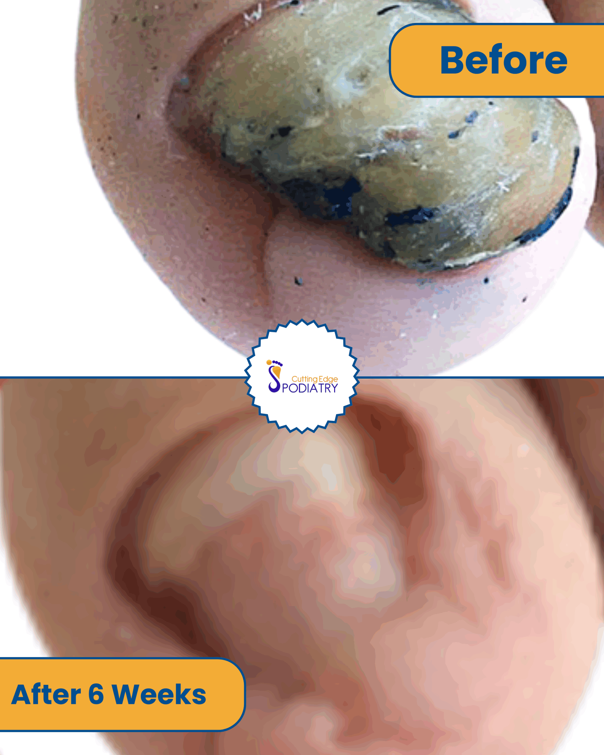 poderm before and after