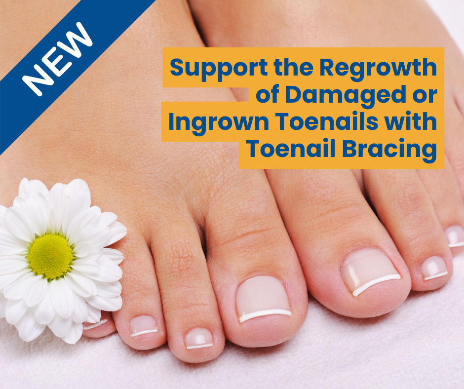 ingrown toenail bracing