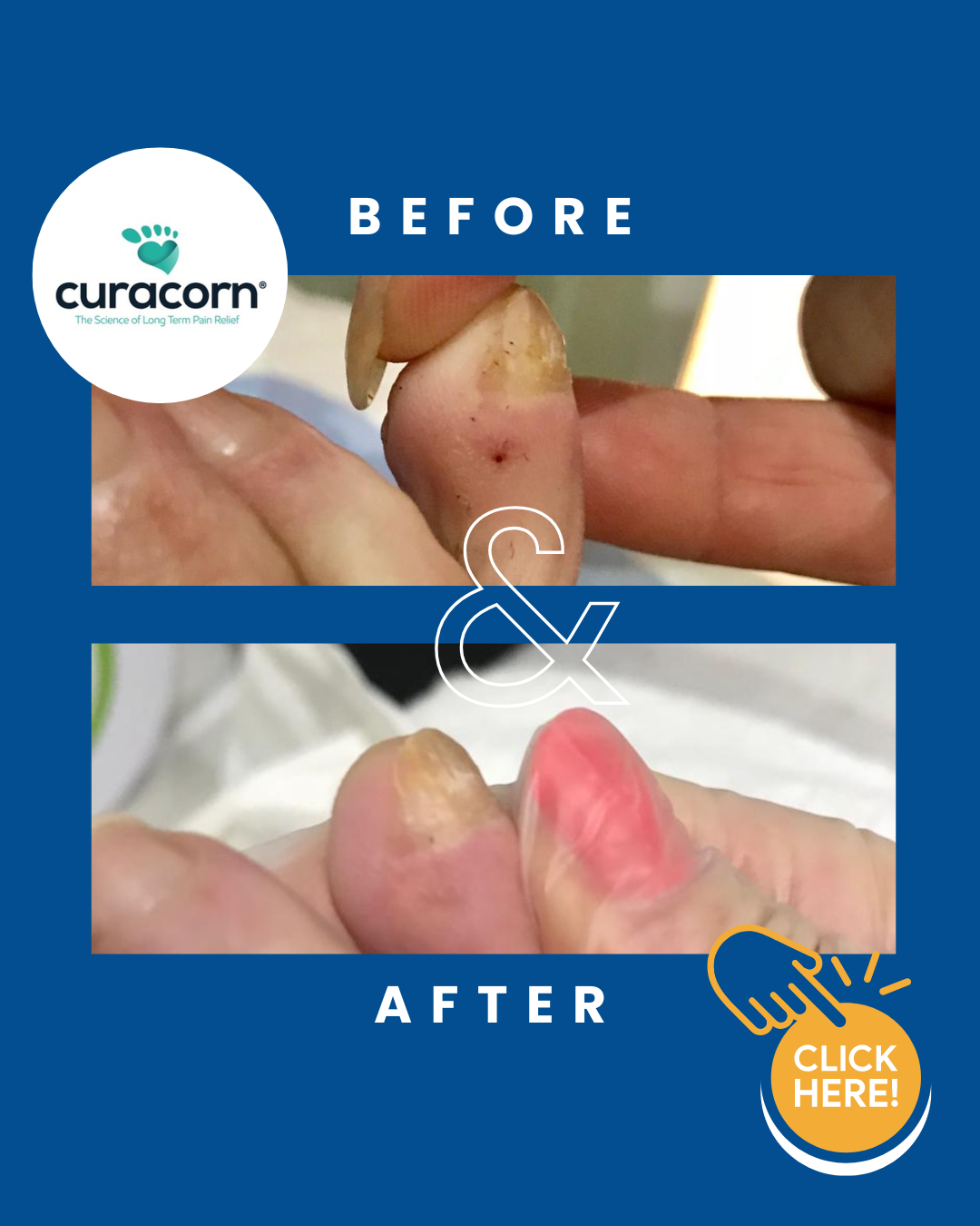 routine foot care cambridge