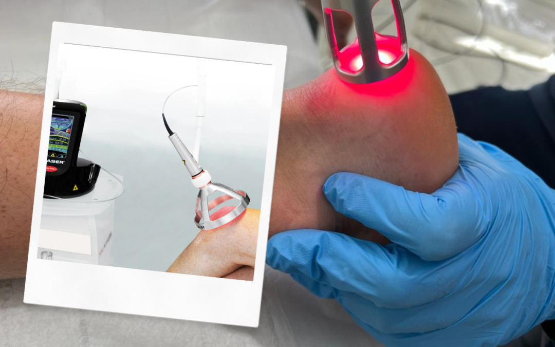 Why You Should Book K-Laser Therapy for Pain Relief