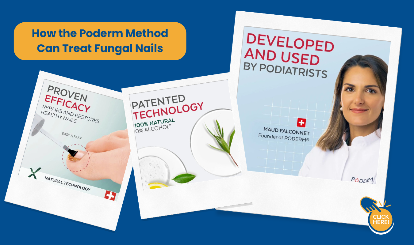 banish fungal nails for good (1350 x 800 px) (1) poderm method