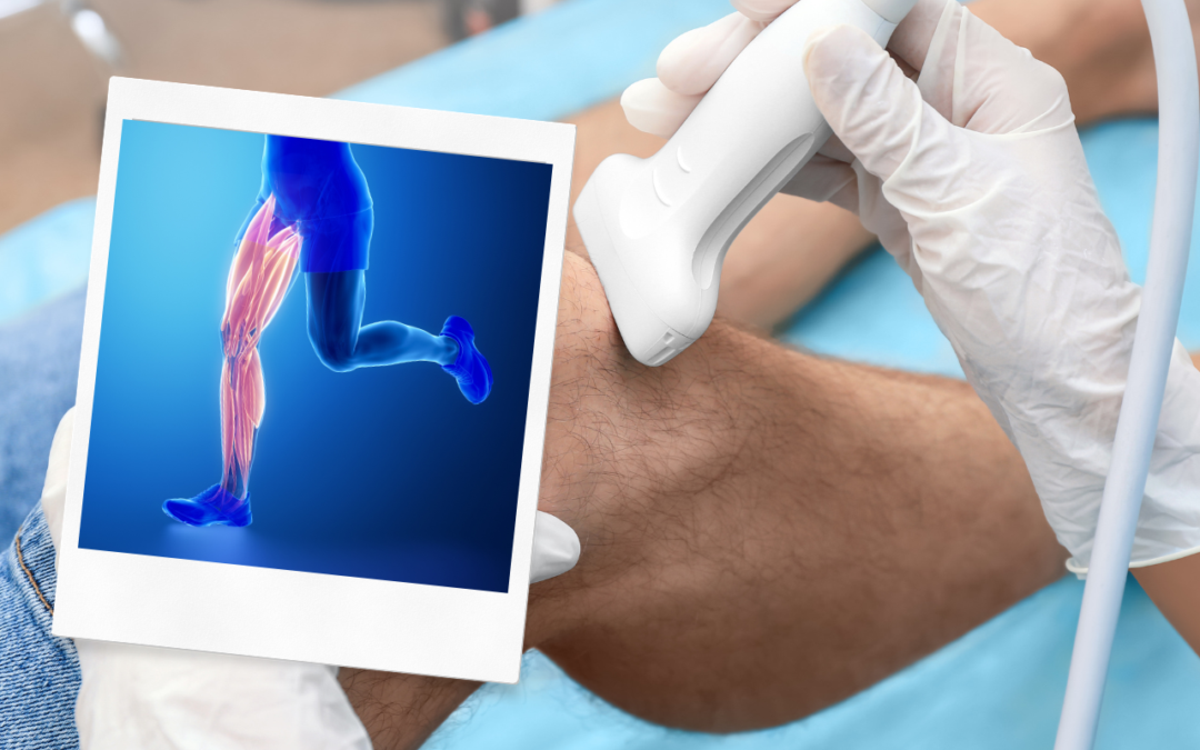 What Can a Musculoskeletal Ultrasound Scan Show