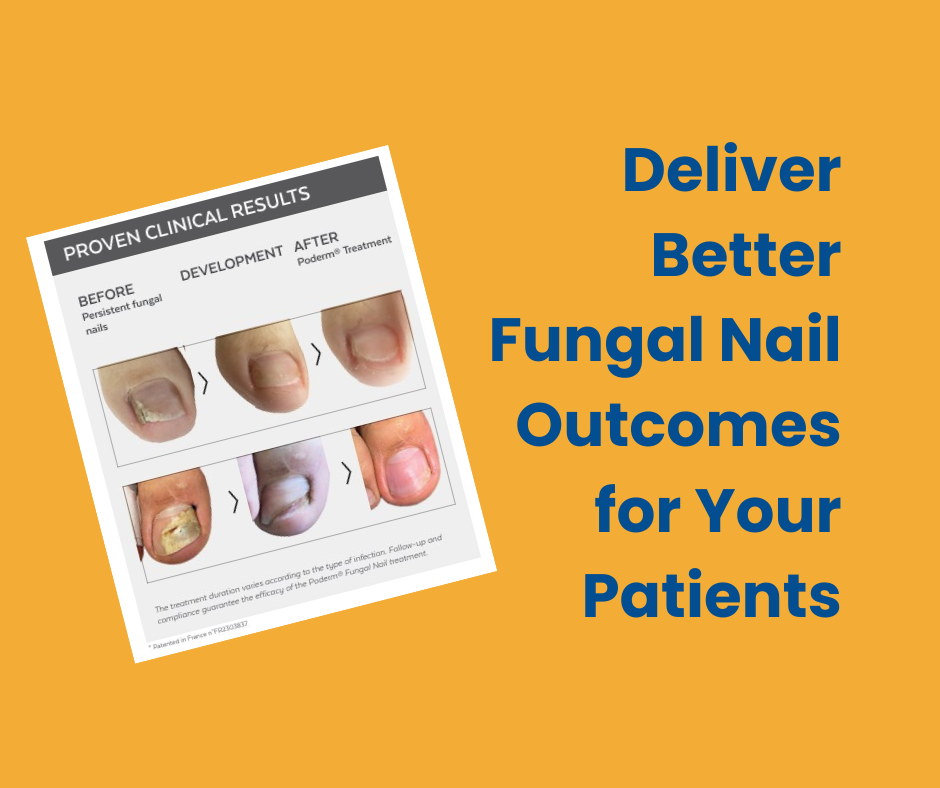 poderm method for fungal nails
