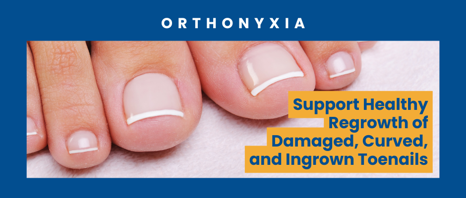 poderm-method-fungal-nails orthonyxia